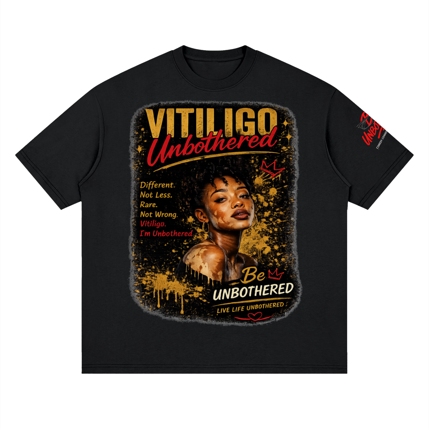 Unbothered Vitiligo Streetwear Loose Drop Shoulder T-Shirt